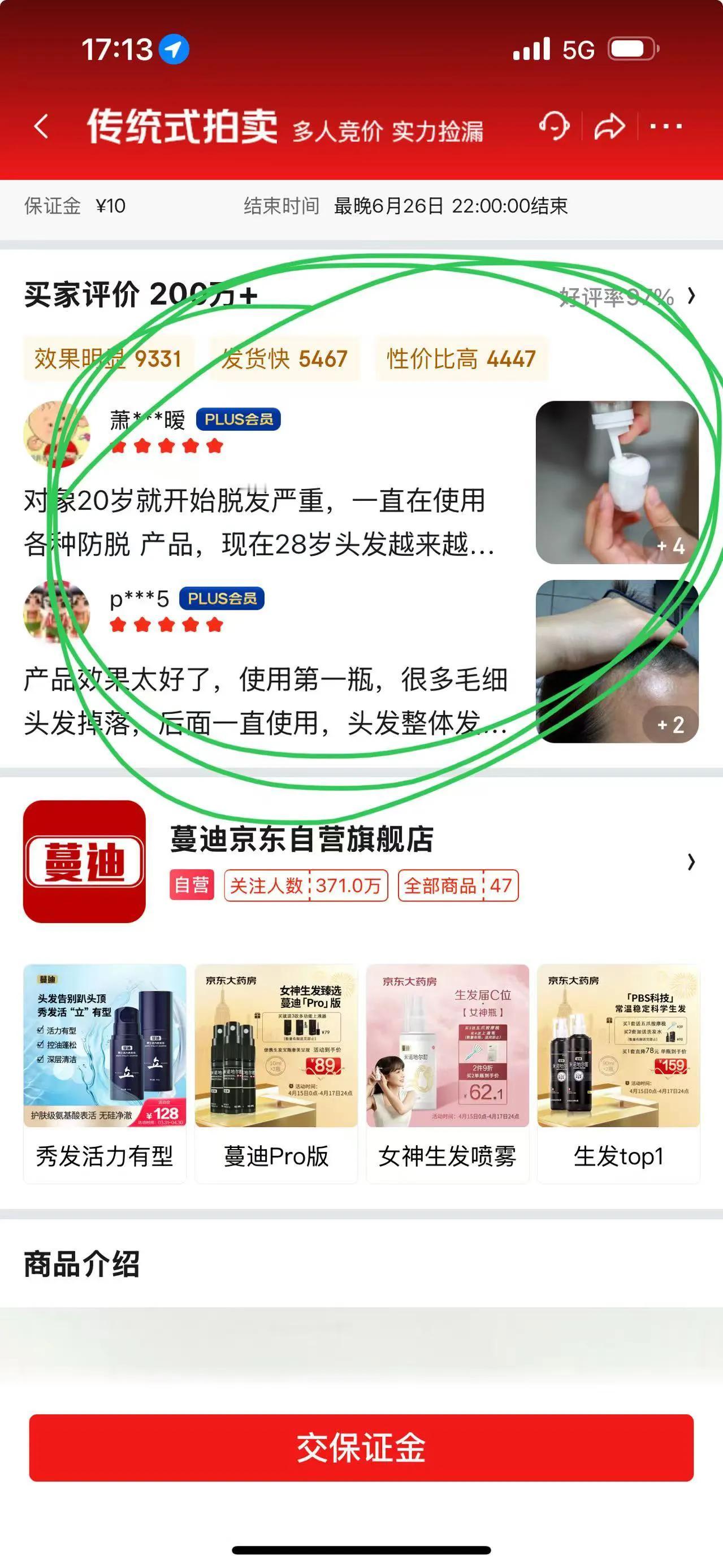 哈哈哈，朋友们，你们有没有发现一个现象？现在满大街都是“地中海”，连我们这些年轻