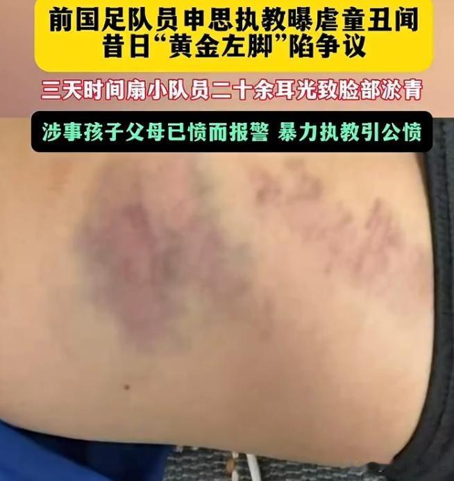 申思:用曾经的经历去教育现在的孩子，四十年过去了，还合适吗？
今天不说申思能不能