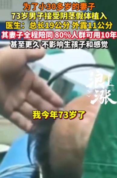 “这是真爱！”73岁大爷为小30岁妻子植入19公分假体，妻子全程陪护，事后，医生