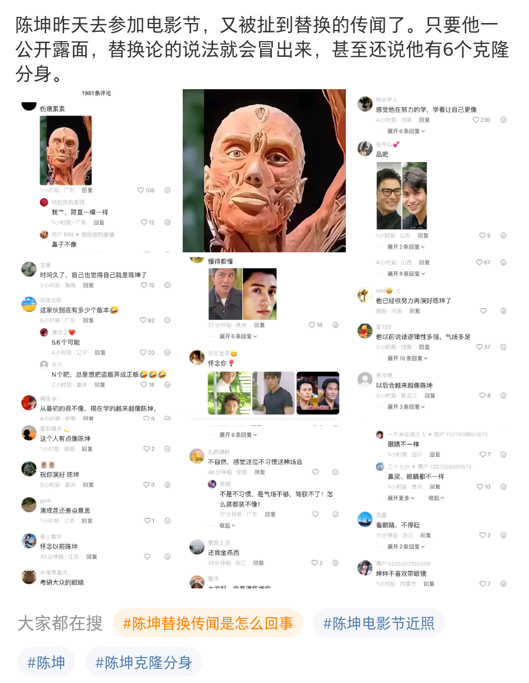 神经病，他只是整了+老了 