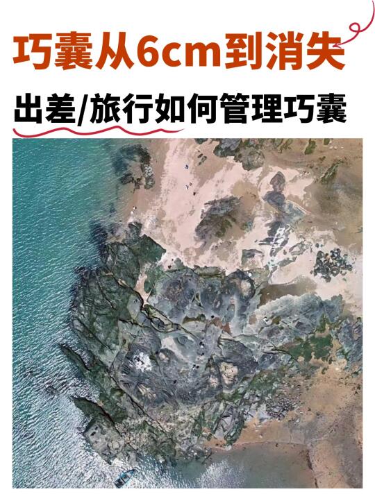 出差党必看！巧囊旅行管理，我私藏抗炎清单