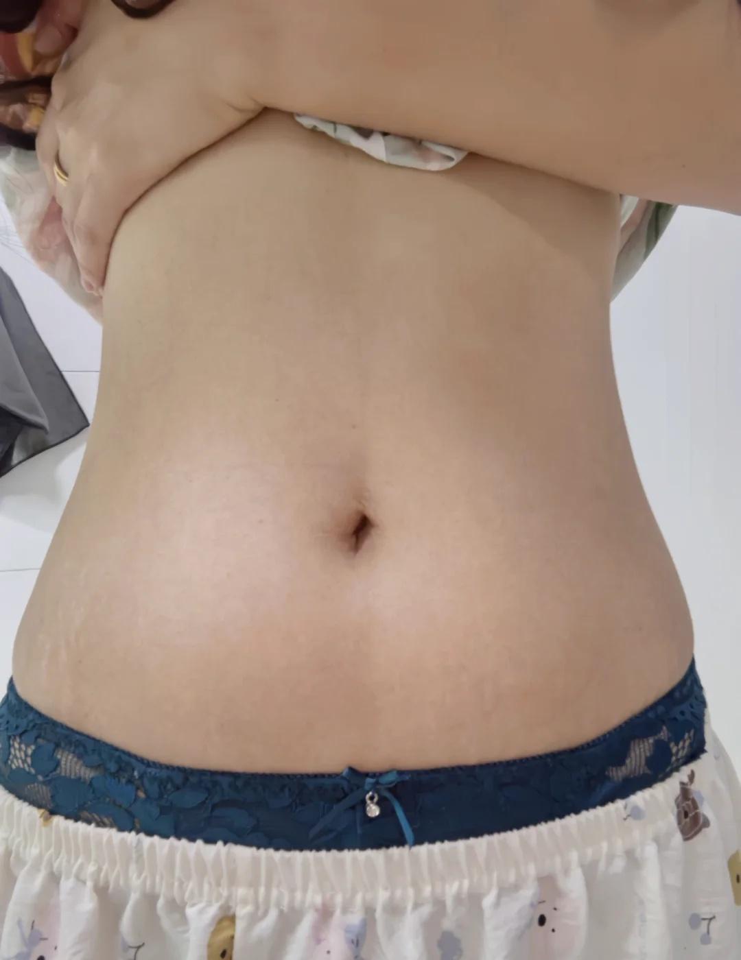 昨晚吃的有点多
[流泪]腹部训练 腹部年轻化 感觉身体被掏空了 女生的肚子是可以