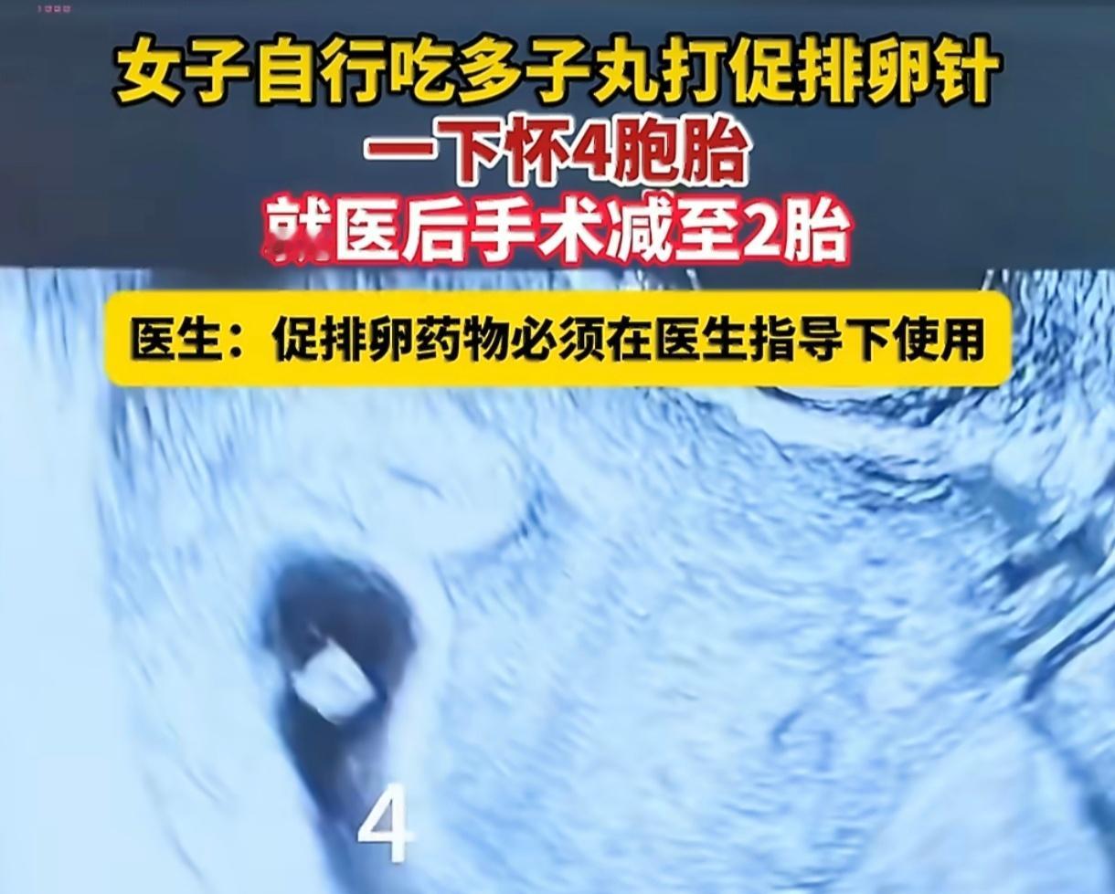 女子自行吃多子丸一次怀4胞胎自行吃多子丸怀上四胞胎，背后是盲目求多胎的错误生育观
