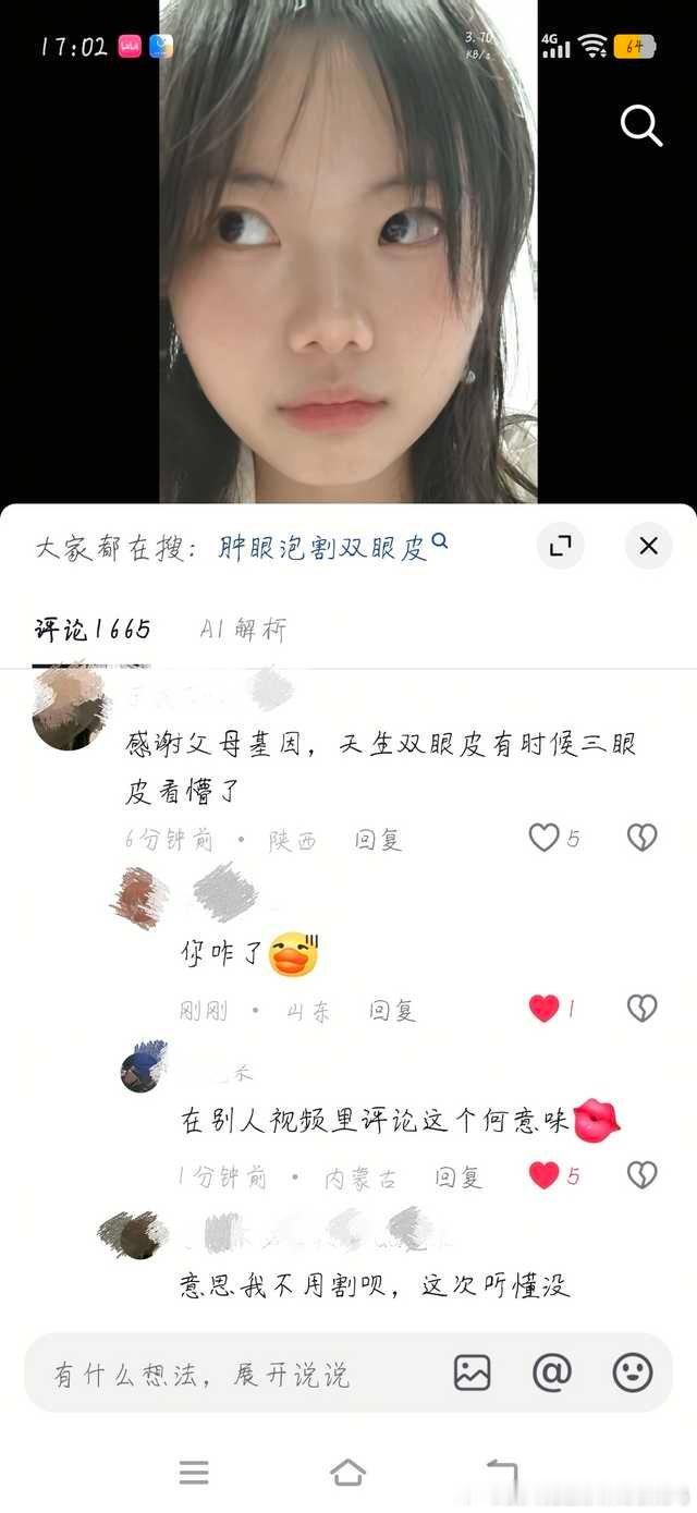 原视频是一个女孩子割了一个很自然漂亮的双眼皮20194 