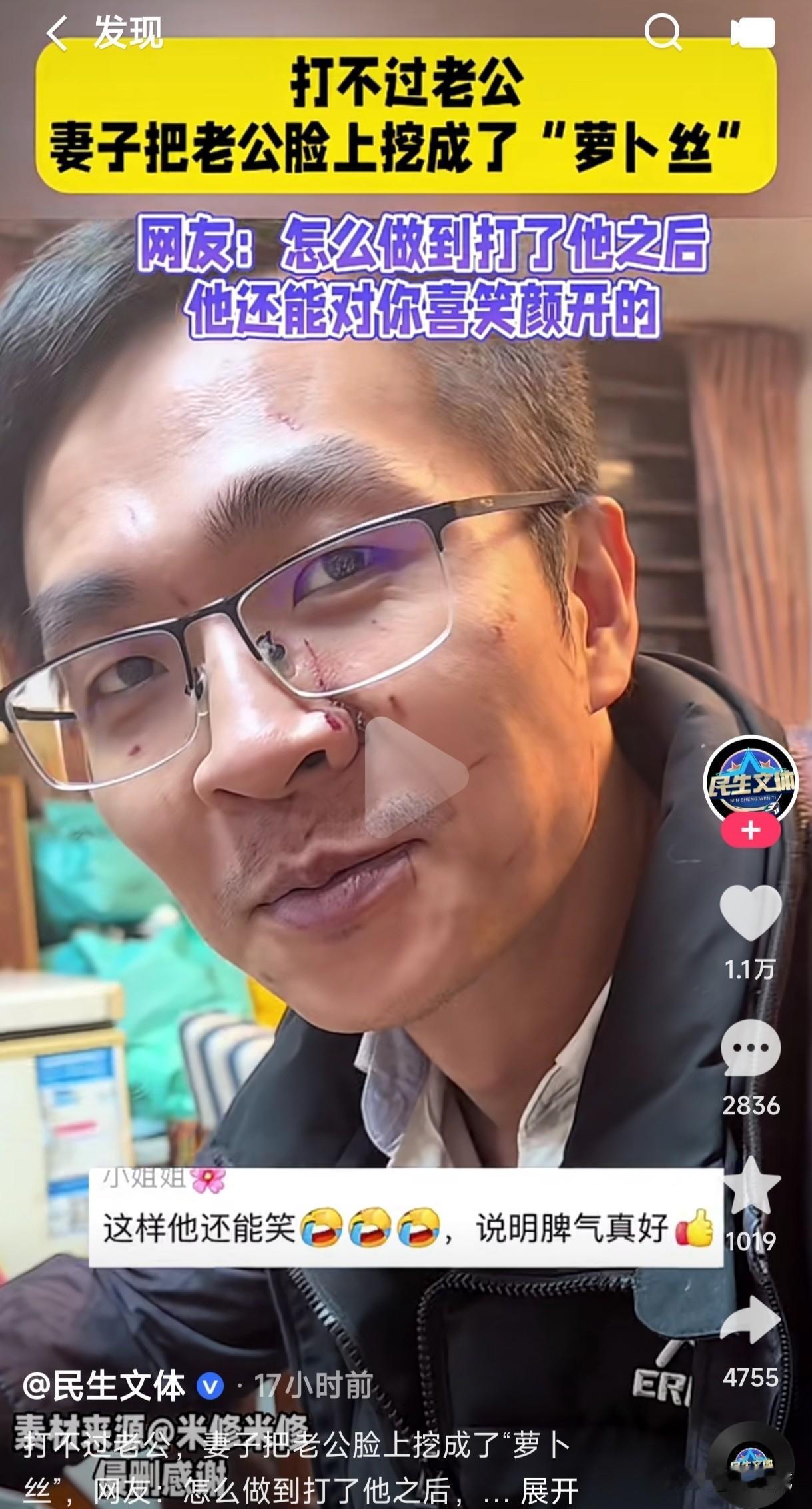 打架抓脸是女人的通病吗？
女子和老公打架，打不过老公居然把他的脸挖成了萝卜丝，这