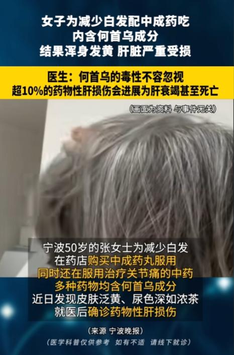 “药不能乱吃！”8月21日报道，浙江宁波，一女子为了减少头上白发，自己去药店买了