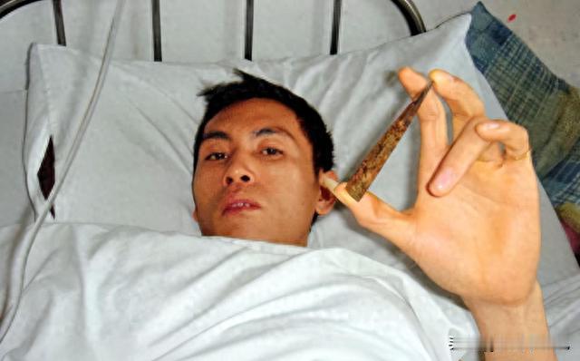 2011年，云南男子突然头痛，妻子正在给他按摩，没想到他突然头晕目眩，吐出一口鲜