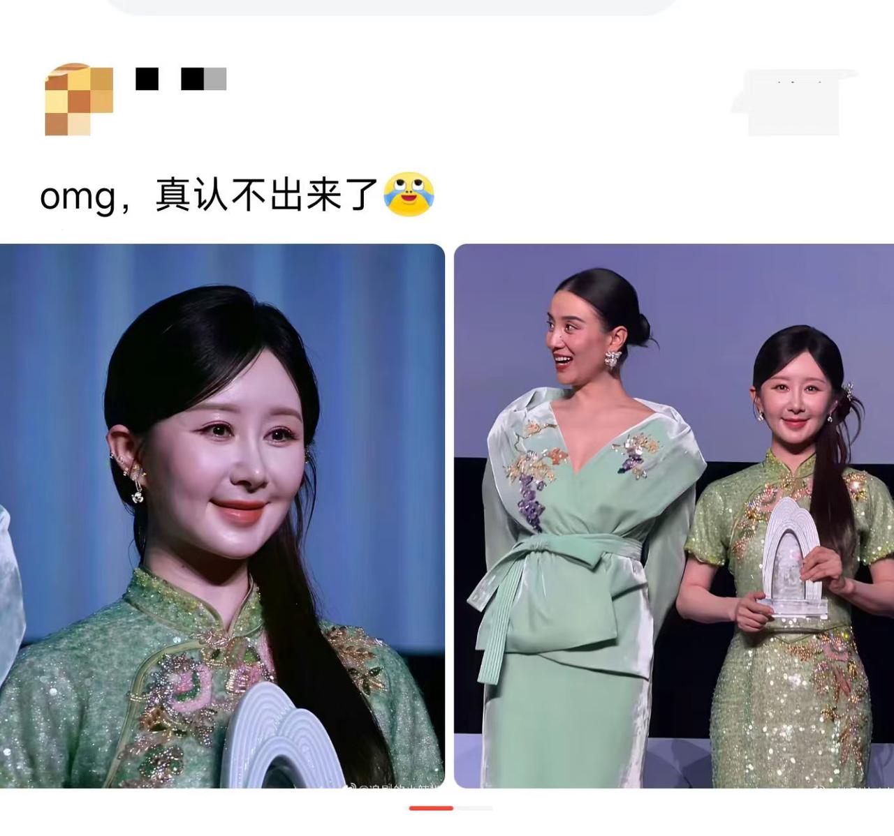 这是做了医美吗？都不认识了