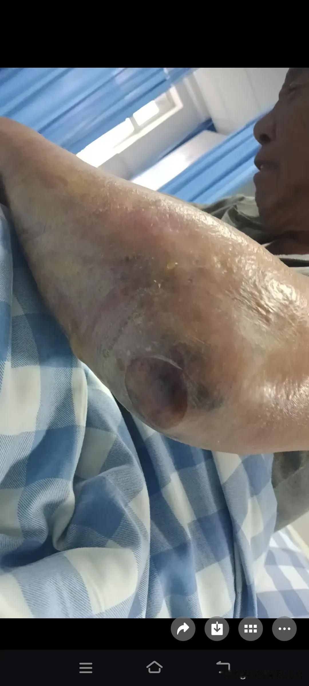 一进医院大门，甭管三七二十一，先做一大堆检查再说！
昨天我爸从县城来到市州人民医