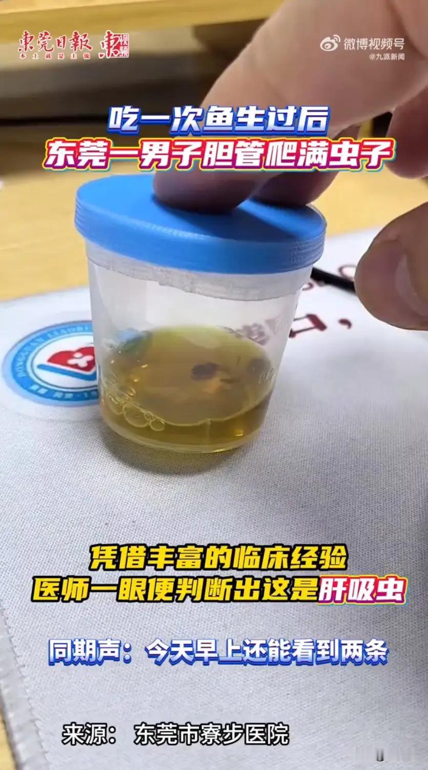 【男子吃鱼生后胆管全长满虫子，医疗奇迹背后隐藏的人性光辉】

近日，一则令人震惊