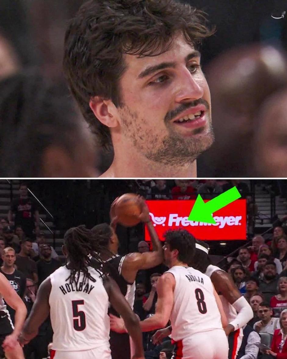 阿夫迪亚被毁容了。福克斯突破，一肘砸开阿夫迪亚的脸，前者被吹犯规，抱怨，挑战，成