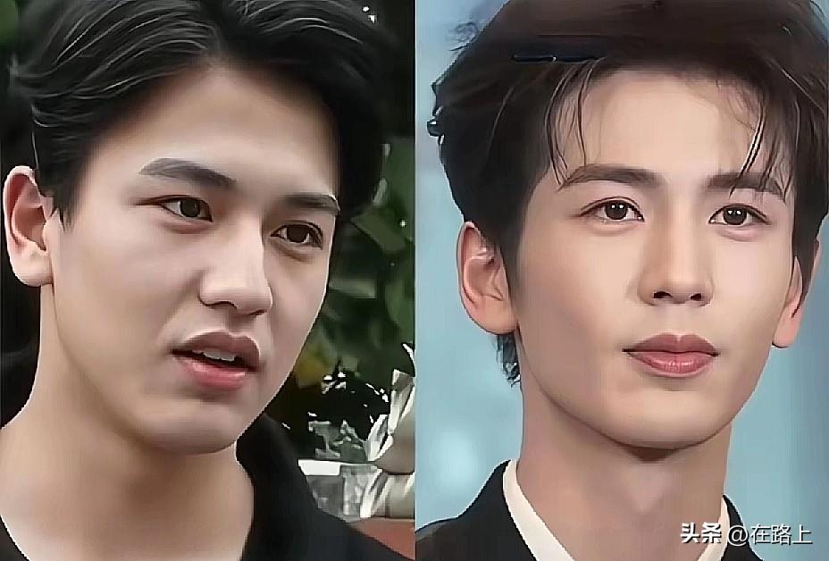 张凌赫到底动没动脸？翻出他九年前的照片，这对比我直接沉默了
最近总有人质疑张凌赫