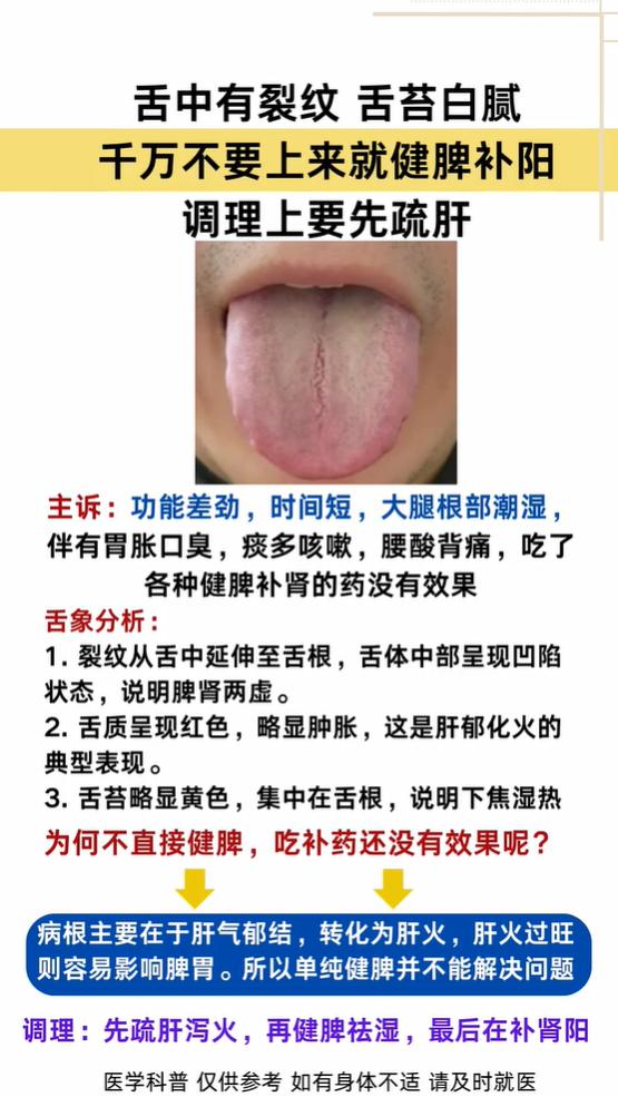 舌中裂纹伴白腻苔，别急着健脾补阳