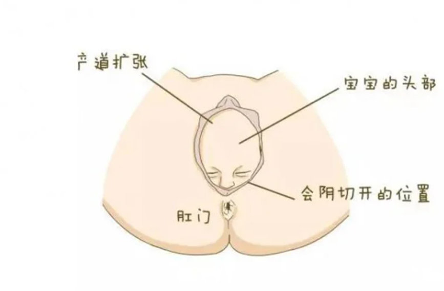 孩子从母体出来的一瞬间是什么感受。。。 ​​​