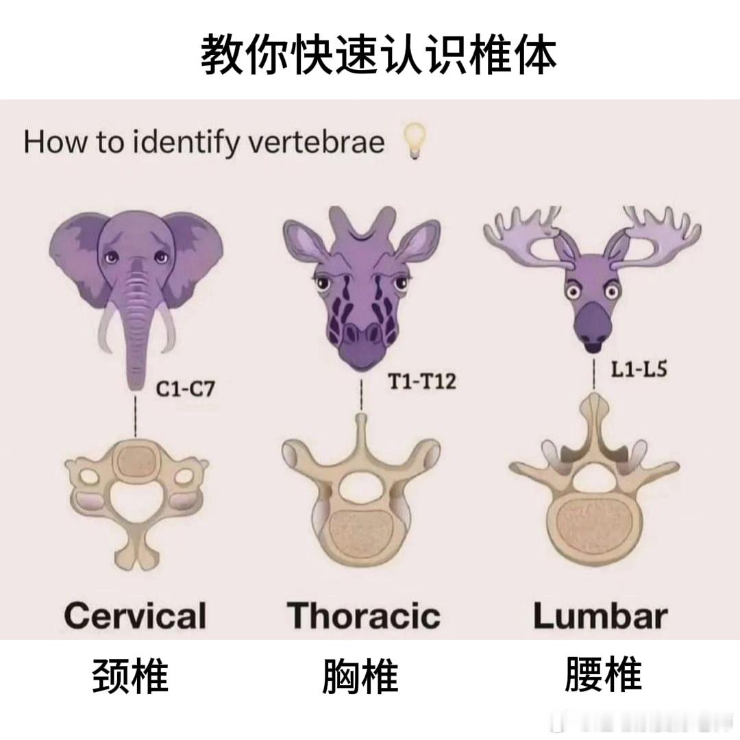 #脊柱# 一张图来认识你的脊柱椎体——拍完片子，显示颈椎反弓了、胸椎曲度变直、腰