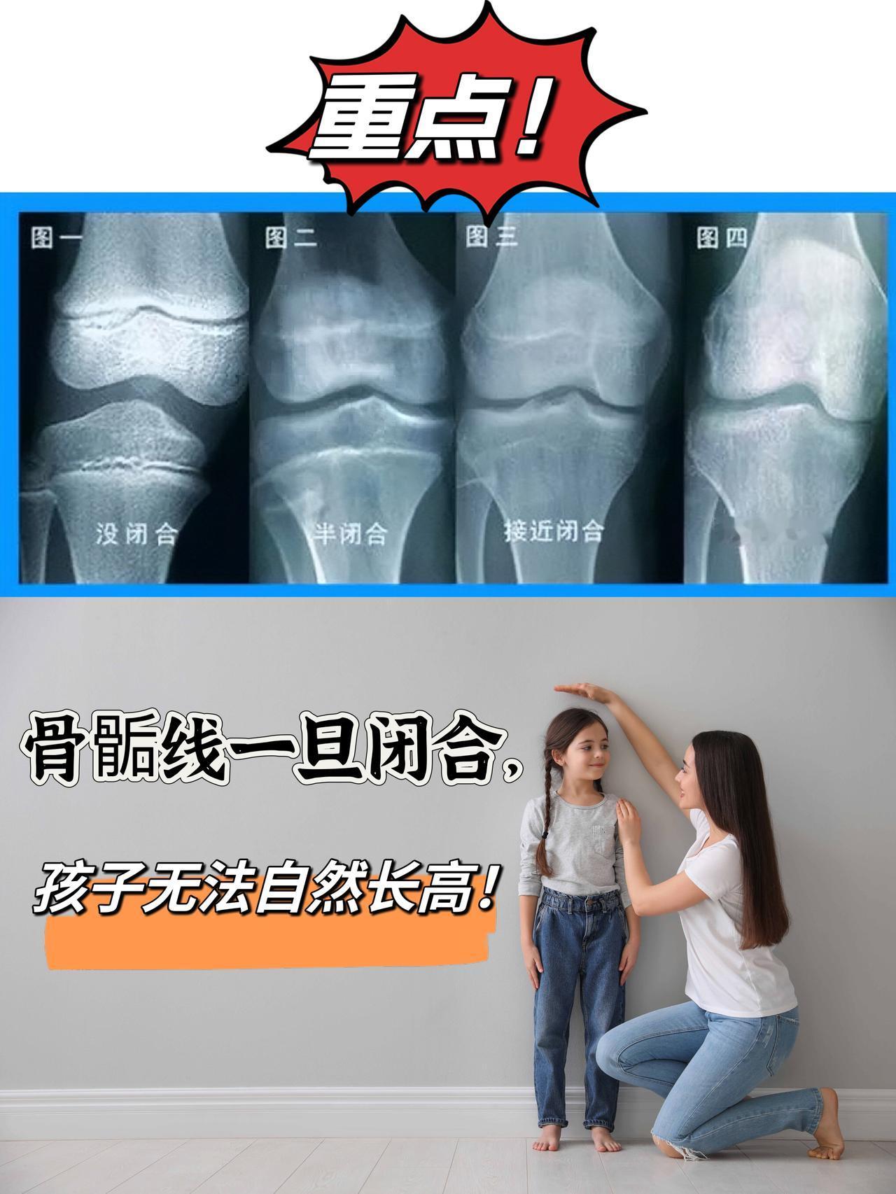 重点！骨骺线闭合了孩子无法再自然长高！你知道骨骺线闭合有哪些征兆吗？
首先，最简
