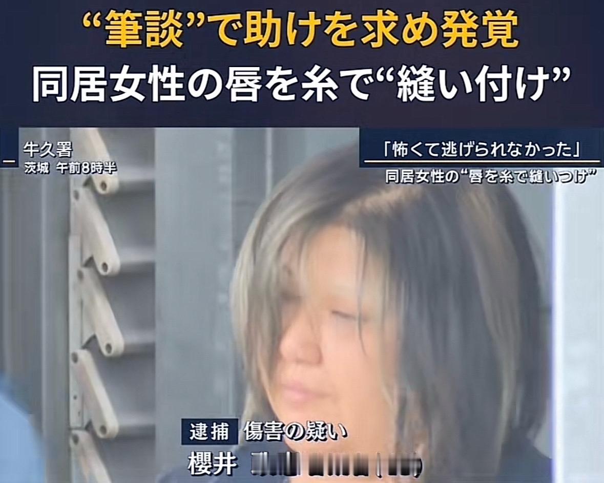 日本茨城县发生一女子嘴巴被同居的女人缝上只能跑到便利店写字求助的怪事。嫌犯樱井政