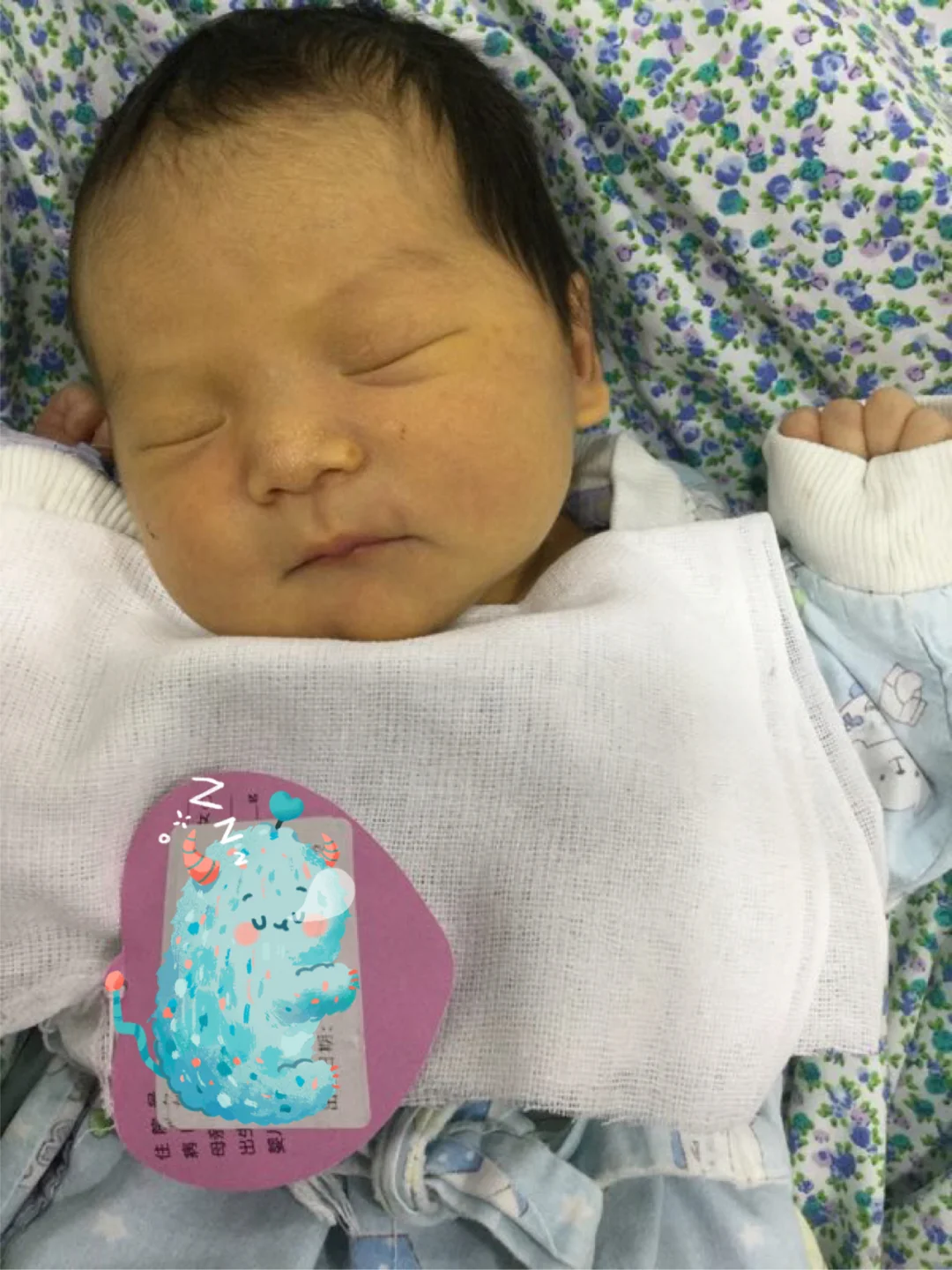 O型血的孕妈产检的时候留意下这个吧😭😭