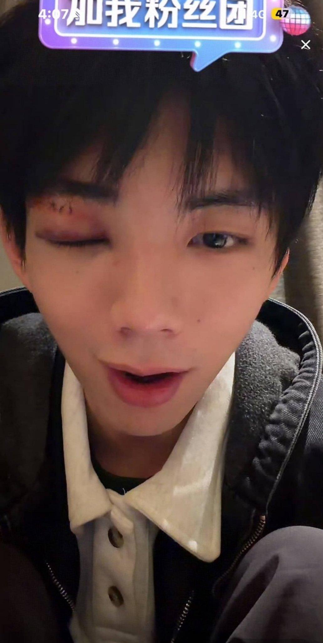 短剧演员拍戏被真打？？为啥这么狠。。。 