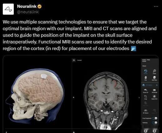 抑郁症不是情绪感冒，它是一种需要严肃干预的疾病。世界卫生组织的数据冰冷而庞大：全