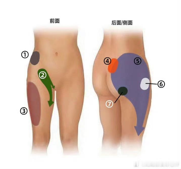 久坐之后，屁股和腿不舒服，但很多朋友说不清具体位置。来看下图的位置划分，你的臀腿