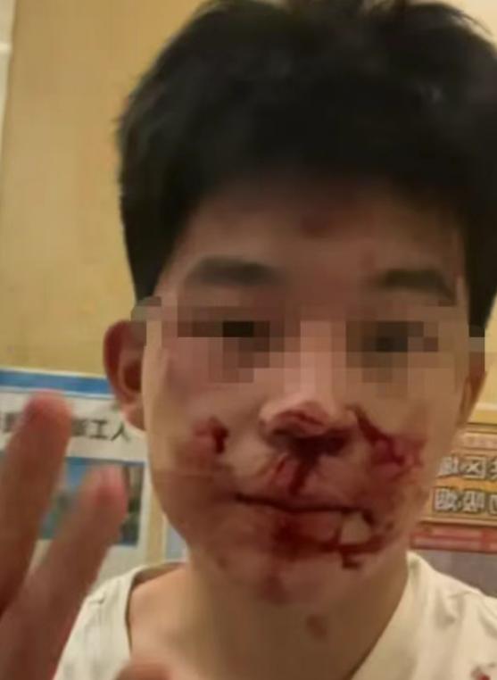 冒充民警打人者拘12天，借高考名义提前释放，22万买受害者闭嘴！民警子女就能肆意