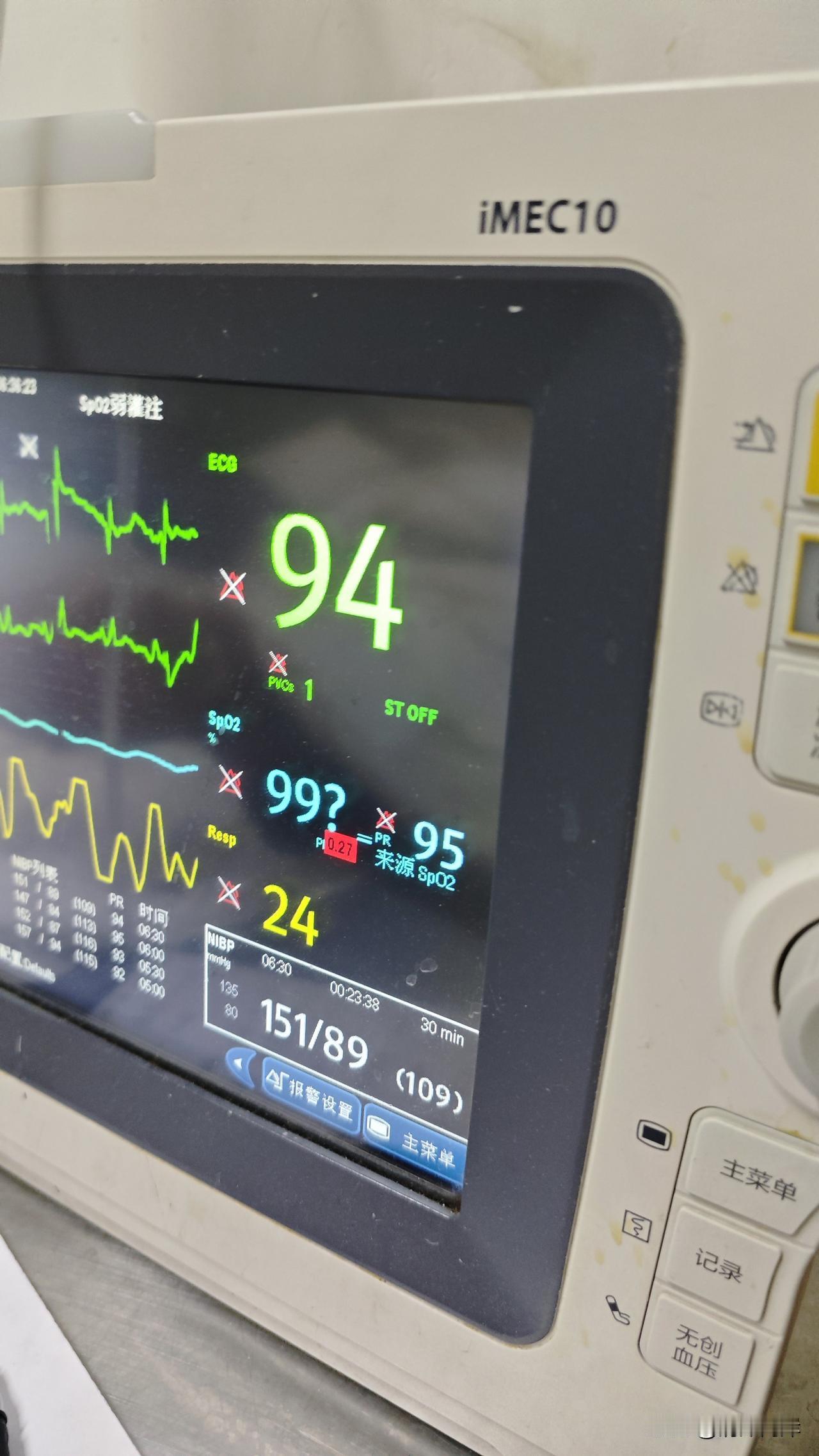 今天是母亲住院的第36天。昨天晚上出现了险情。夜里1:40的时候，监控器里的心率