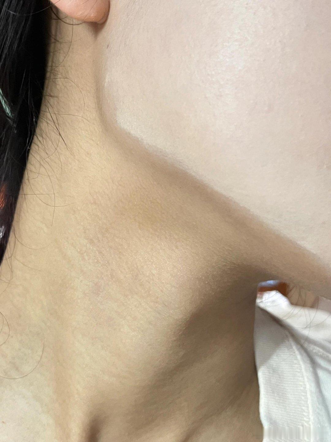 #这是要把粉底液拍进细胞核吧#冬天混油皮不会卡粉 做好妆前保湿 特别是鼻翼眼下然