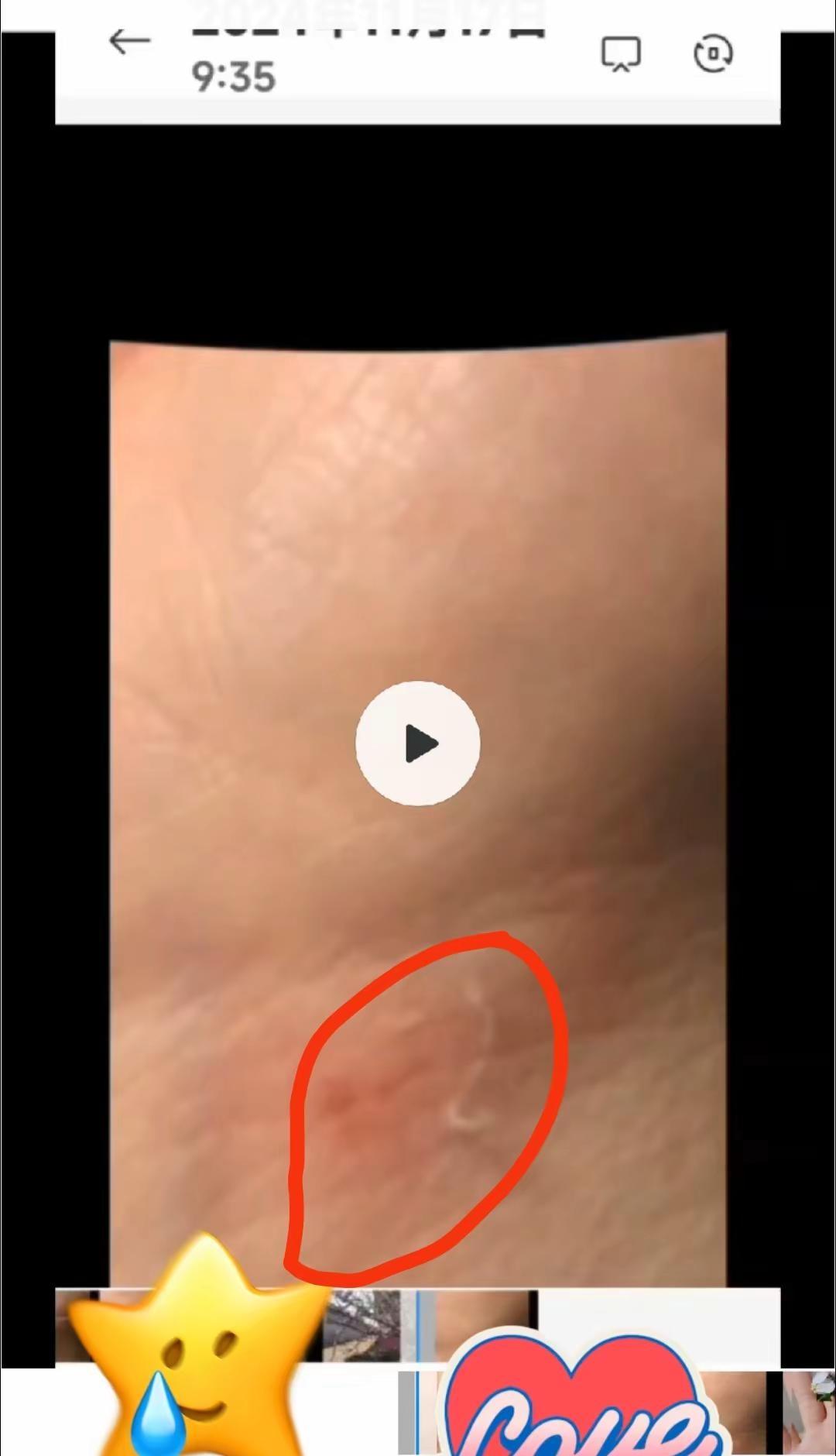 @下班路中午十二点上救下女孩抱起来伤手腕拉🇨🇳🇨🇳🇨🇳