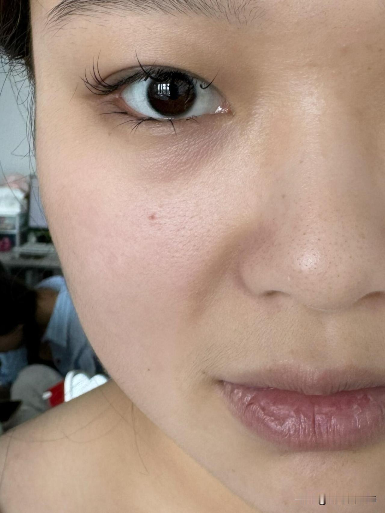 才23，垮脸垮成这样还有救吗
21岁垮脸垮成这样，看上去有40岁，每天都很焦虑，