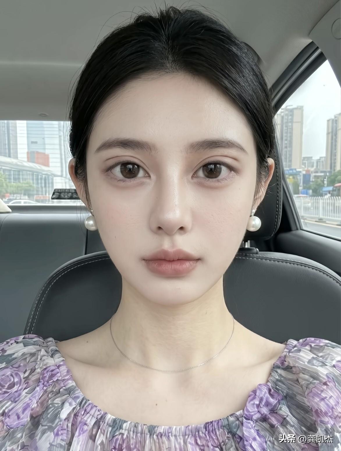 这双眼皮手术有点失败啊！一下子老了许多。