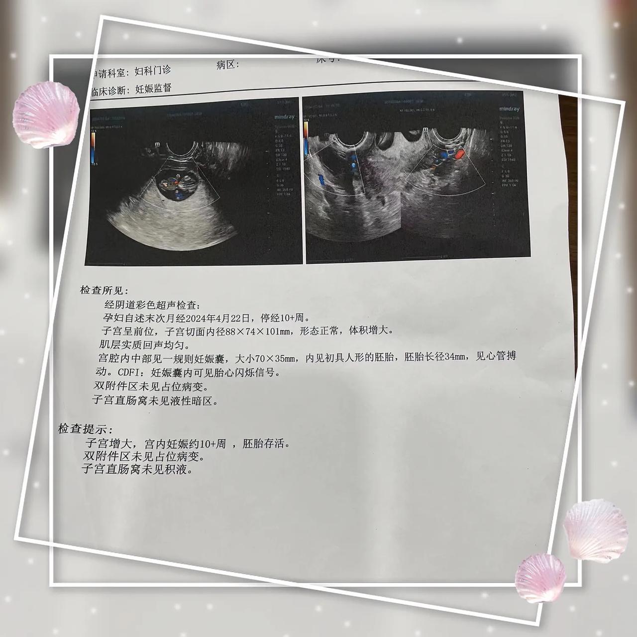 好孕案例分享：这个姐妹在外面调理 搞得月经都不正常了🧐然后就过来看诊调了一个月