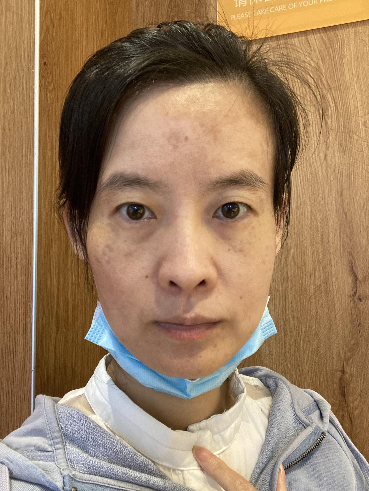 我毁容了，可是我却毫无办法，因为我在农村。