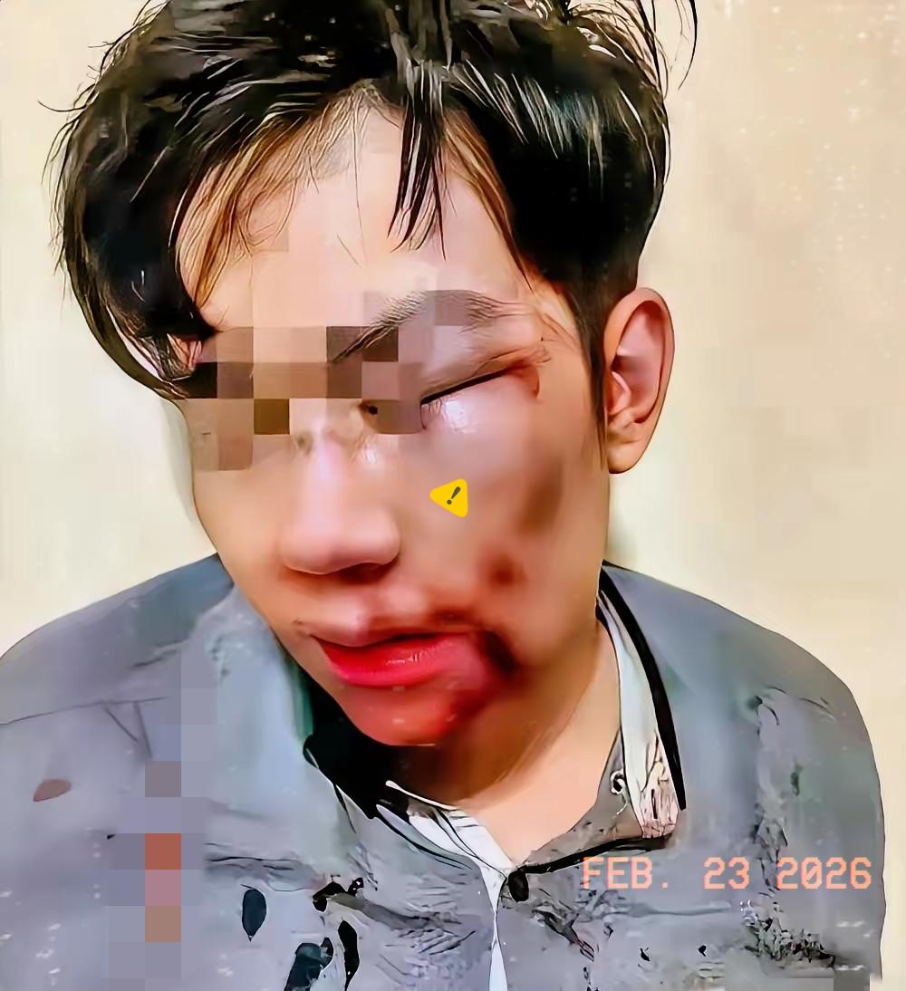 女子远嫁，老公觉得她娘家远经常家暴她。今年春节多年没有回过娘家的妻子想回娘家看看