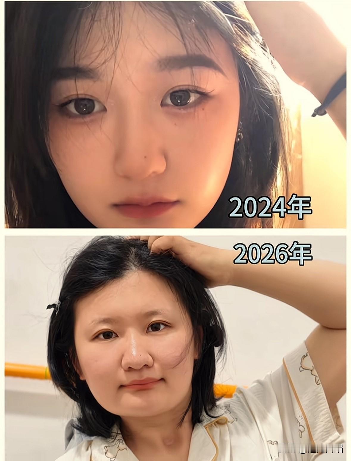 看到一个网友说她自己患有脑出血的亲生经历：当她脑出血发病的时候是突然一下好疼，那