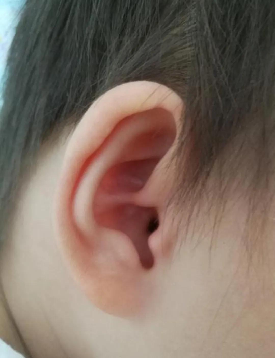 耳朵小又贴，迎面不见耳。
拍照身份证，每一次照相，都要垫东西才可以。
还好，我的