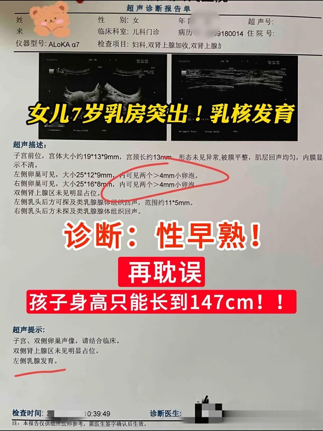 女孩x早熟，骨龄偏大2岁半，不打抑制针，保守治疗抑制骨龄，助长高！
 
延缓骨龄