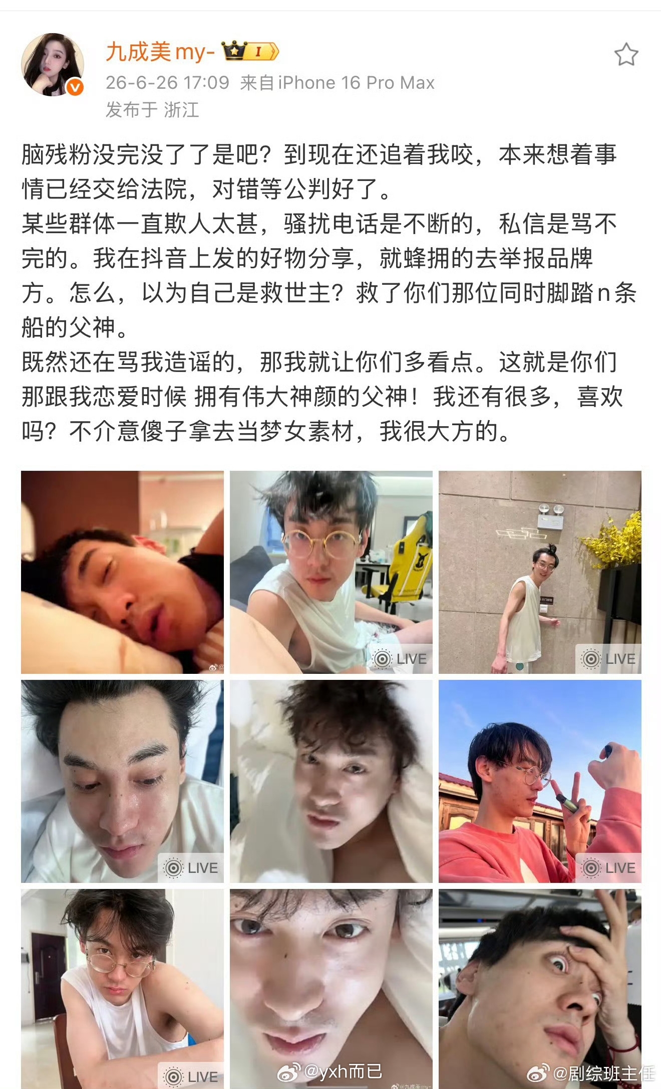 九成美发田栩宁素颜怎么大家睡觉都爱口呼吸 