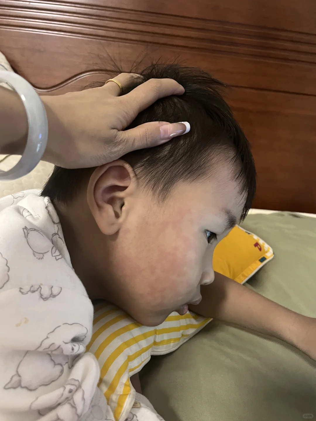 这是过敏了吗？？？
