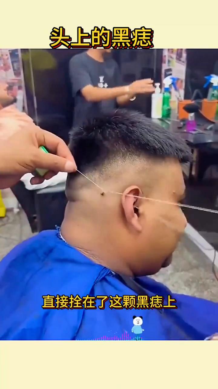 头上的黑痣。
眼前的男子在理发的时候突然发现了自己的头上长了一颗大黑痣，在理发的