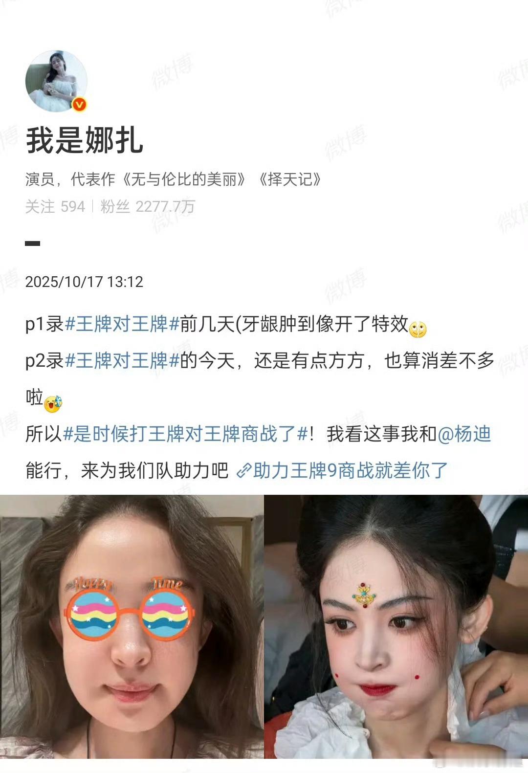 娜扎肿成蜜蜂小狗哈哈哈，这个娜扎真的太可爱了，蜜蜂小狗太形象了 ​​​