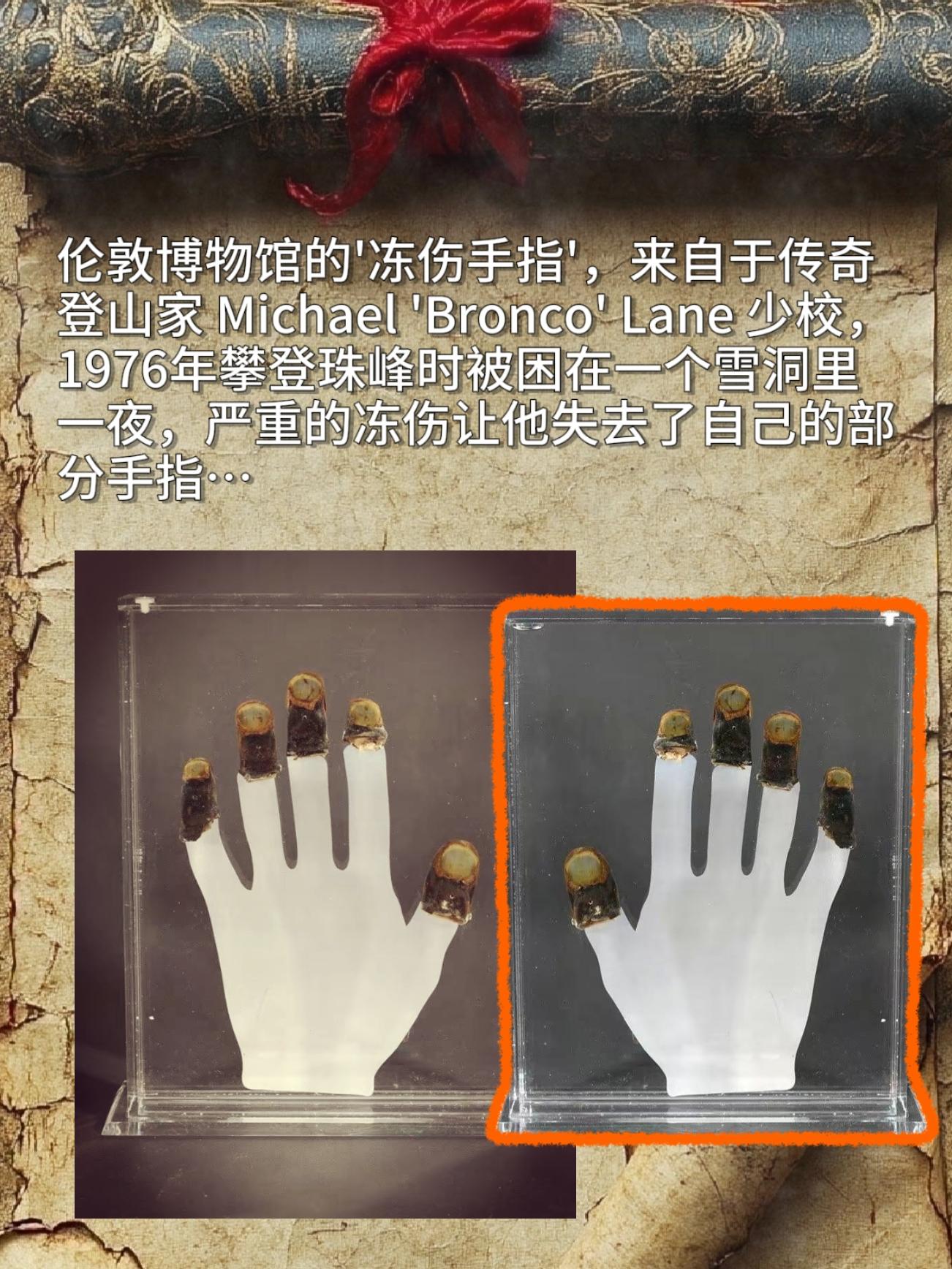 伦敦博物馆的'冻伤手指'，来自于传奇登山家Michael'Bronco...