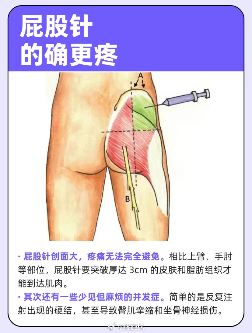 【#小时候流行的屁股针为什么消失了#】西医打针、输液、手术都是创伤性治疗！ ​​