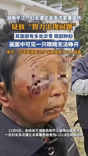 这才是家暴最让人痛心的后果！

湖南平江的大姐，被丈夫多次家暴，现在连自己是