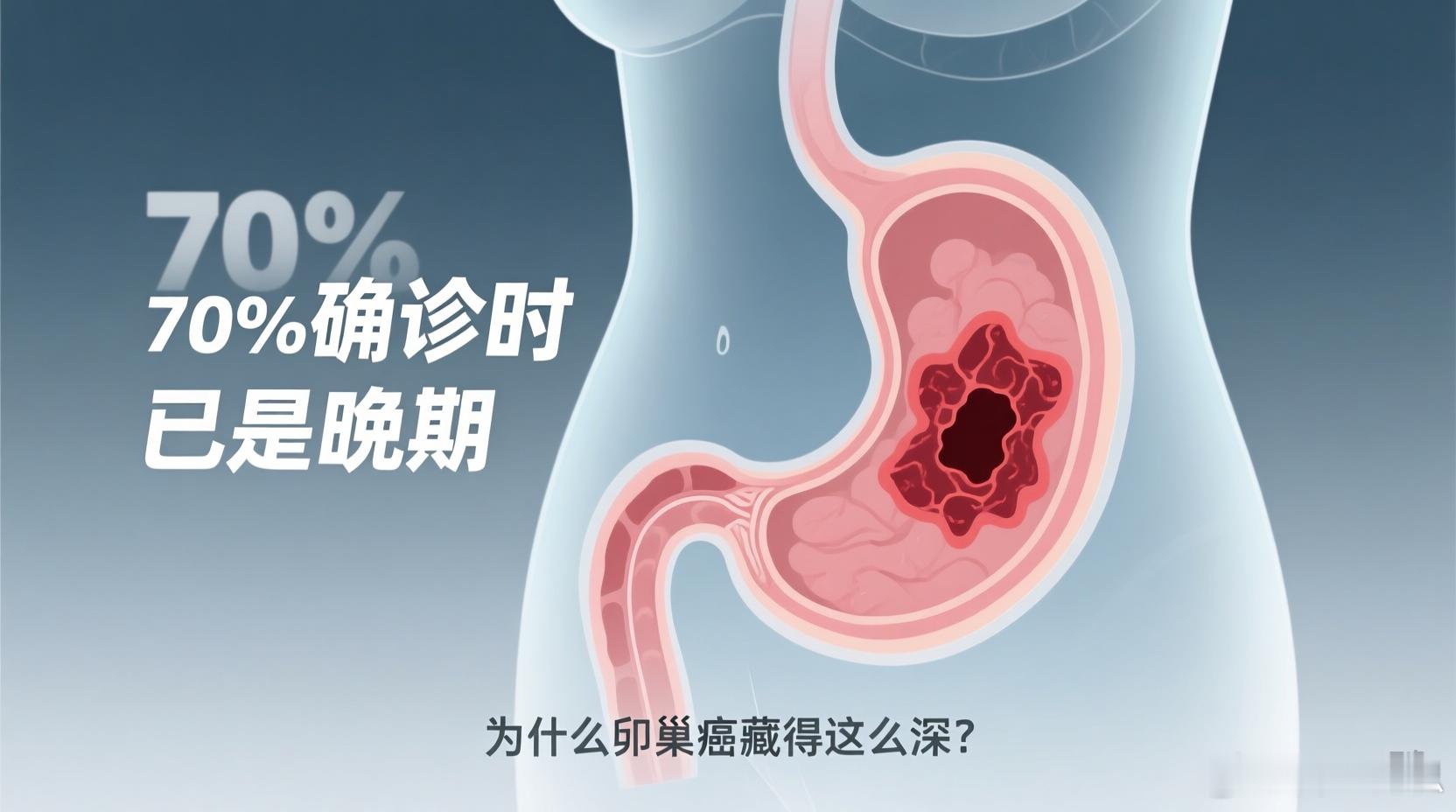 为什么卵巢癌藏得这么深70%卵巢癌患者确诊时已是晚期 卵巢癌被称为“沉默杀手”，