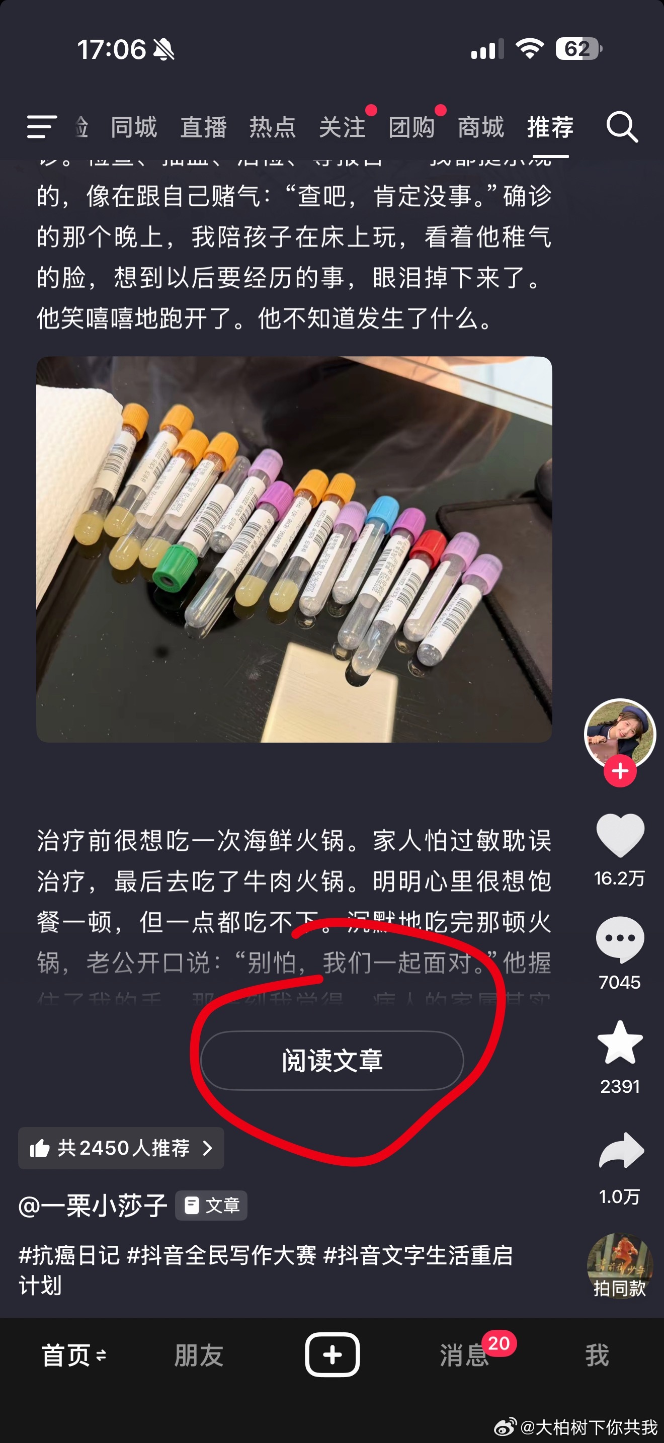 抖音越来越像公众号，小红书越来越像抖音，公众号学小红书弄了个小绿书，fine 中