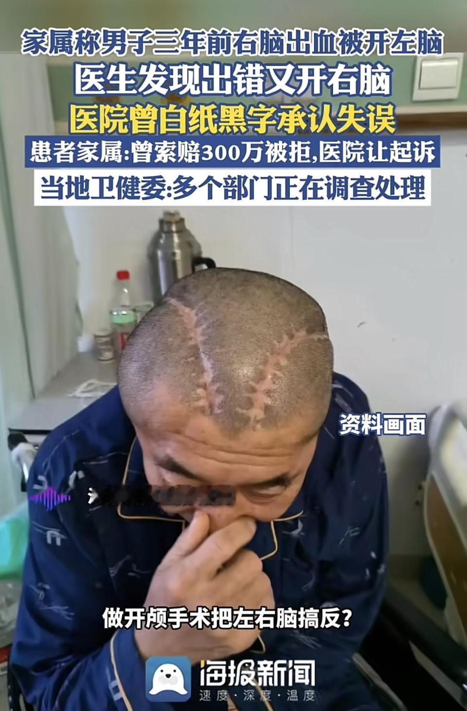 男子三年前右脑出血，医生居然开了左脑，发现出错又开右脑，医院白纸黑字都承认失误了
