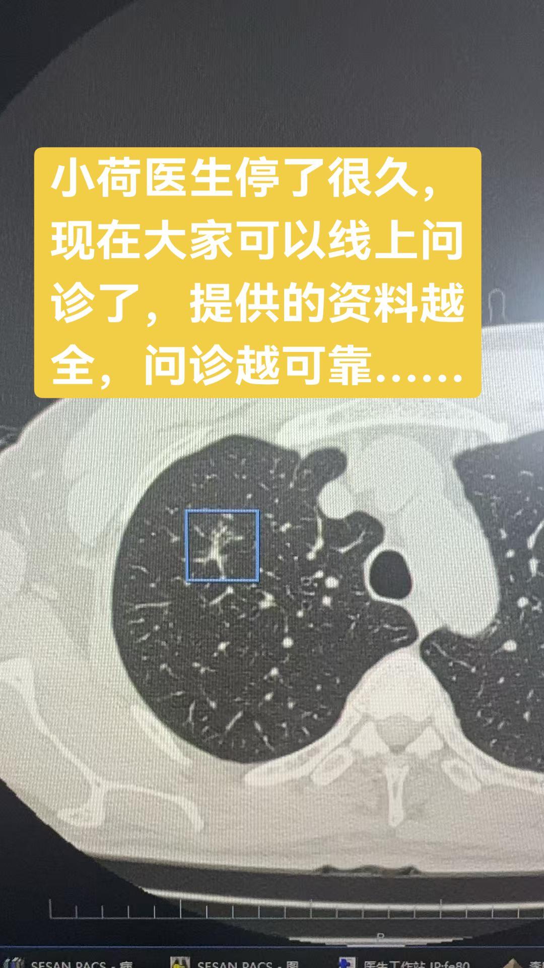 小荷医生停了很久，现在大家可以线上问诊了，提供的资料越全，问诊越可靠……