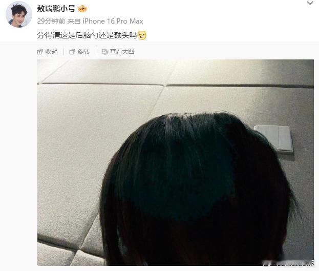 敖瑞鹏这是后脑勺还是额头 都这样问了，我猜肯定是额头！说明头发太长了，挡住帅气的
