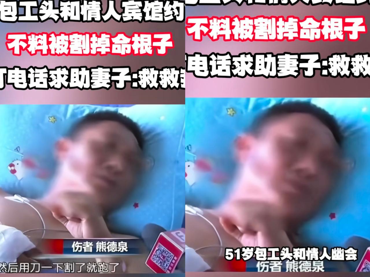 家人们快看这离谱事！
包工头和情人约会
结果命根子被割，还得求妻子救命！
 
这